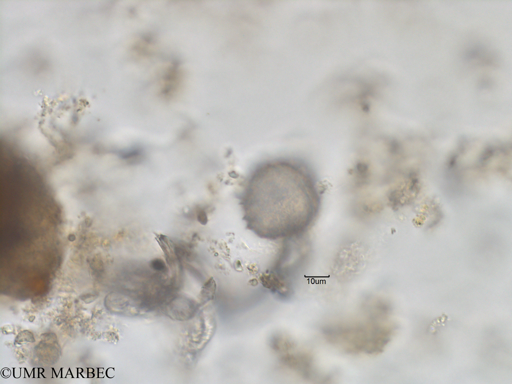 phyto/Bizerte/bizerte_bay/RISCO November 2015/Gonyaulax spinifera (Baie_T1C-Gonyaulax cf polygramma-12).tif(copy).jpg